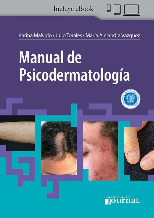 Manual de Psicodermatología